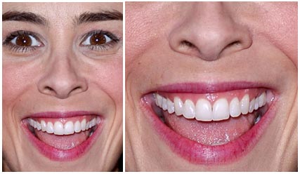 Comedian, Sarah Silverman | Nad's Nose Wax